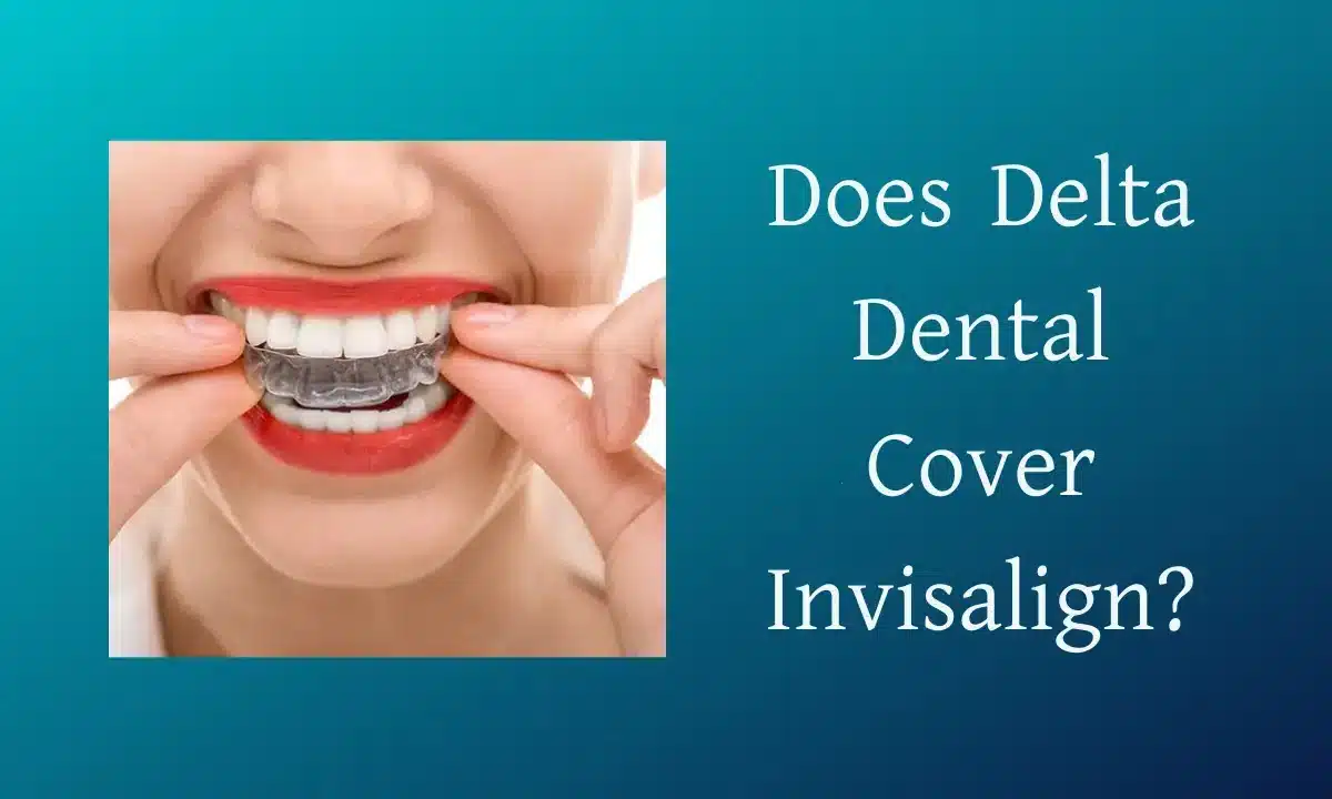 Does Delta Dental Cover Invisalign? Discover Complete Coverage!
