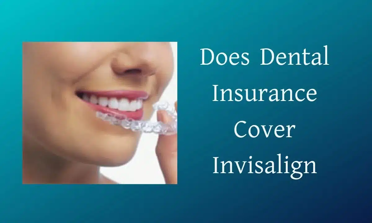 Does Dental Insurance Cover Invisalign 2026